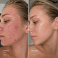 Lavione® AquaCare
